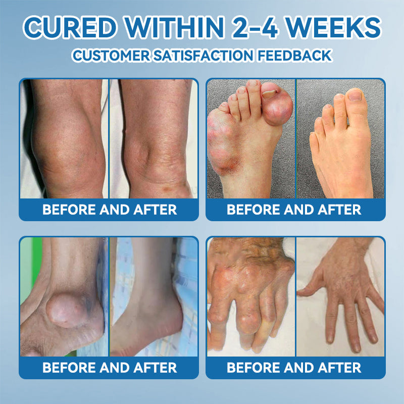 Aeehfeng® 🌿🔥 Only 5 boxes left! Today only — 30% OFF!  ✅ Clinically proven to ease arthritis pain, stiffness & inflammation. Just 4–6 boxes for lasting relief.  ⏳ Hurry, limited stock!