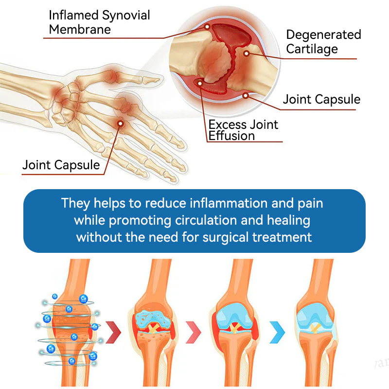 Aeehfeng® 🌿🔥 Only 5 boxes left! Today only — 30% OFF!  ✅ Clinically proven to ease arthritis pain, stiffness & inflammation. Just 4–6 boxes for lasting relief.  ⏳ Hurry, limited stock!