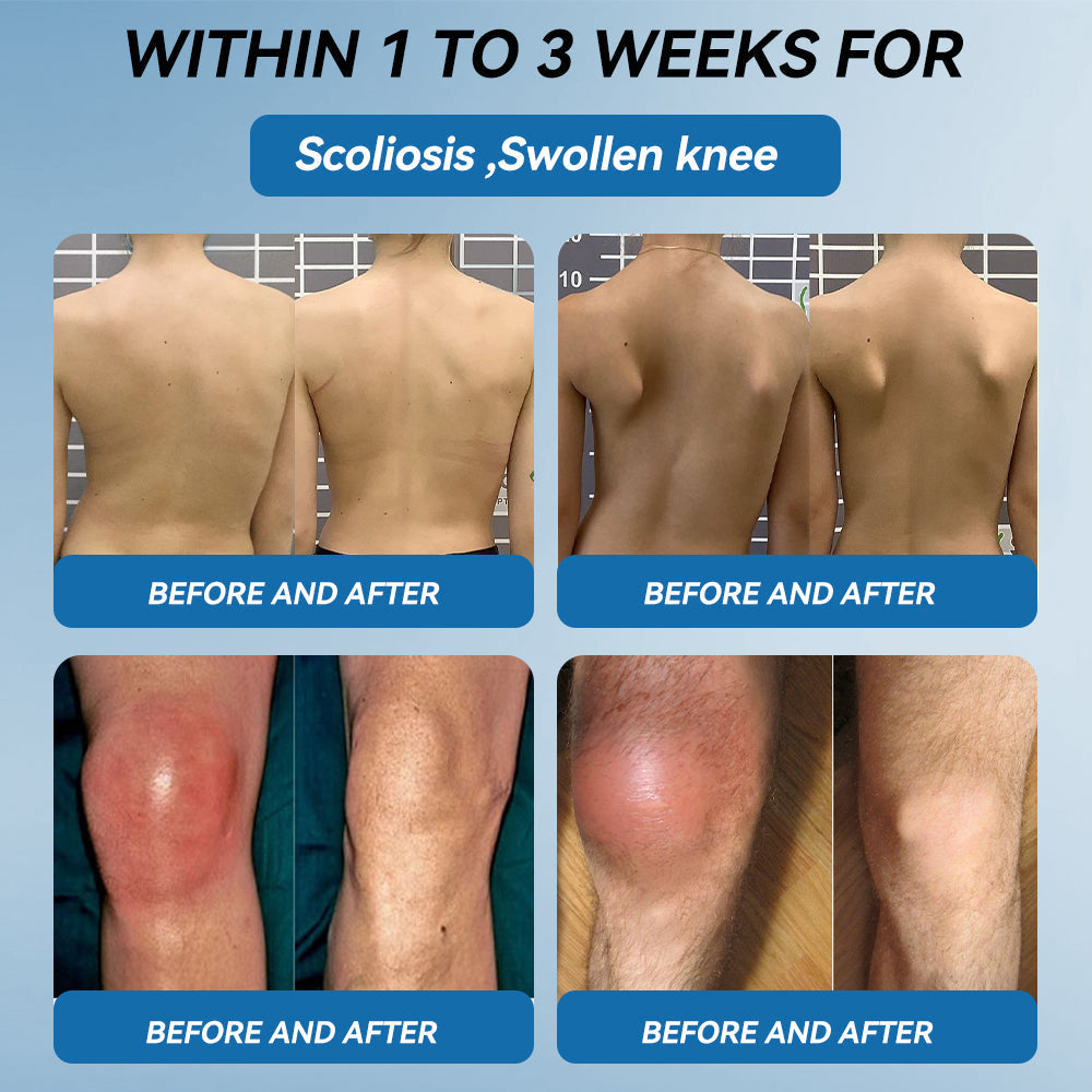 Aeehfeng® 🌿🔥 Only 5 boxes left! Today only — 30% OFF!  ✅ Clinically proven to ease arthritis pain, stiffness & inflammation. Just 4–6 boxes for lasting relief.  ⏳ Hurry, limited stock!