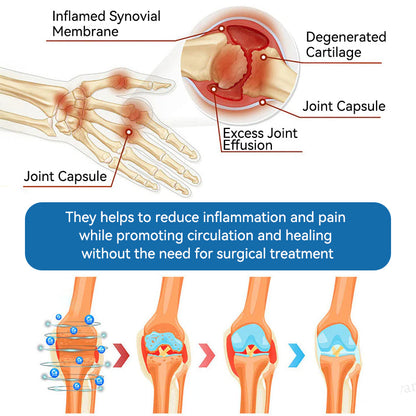 Aeehfeng® 🌿🔥 Only 5 boxes left! Today only — 30% OFF!  ✅ Clinically proven to ease arthritis pain, stiffness & inflammation. Just 4–6 boxes for lasting relief.  ⏳ Hurry, limited stock!