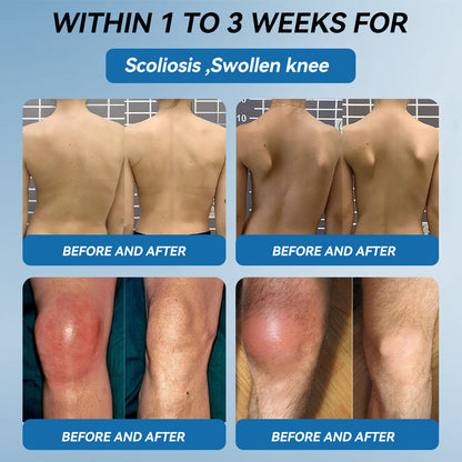 Aeehfeng® 🌿🔥 Only 5 boxes left! Today only — 30% OFF!  ✅ Clinically proven to ease arthritis pain, stiffness & inflammation. Just 4–6 boxes for lasting relief.  ⏳ Hurry, limited stock!