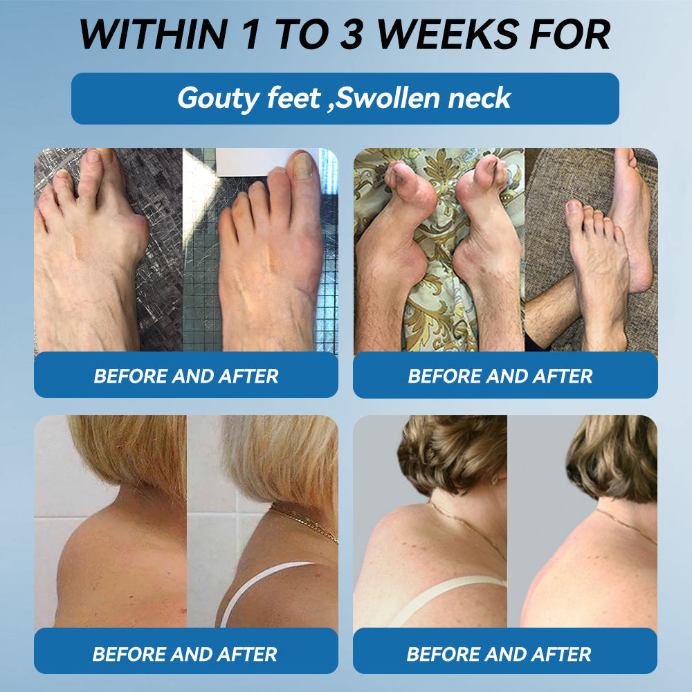 Aeehfeng® 🌿🔥 Only 5 boxes left! Today only — 30% OFF!  ✅ Clinically proven to ease arthritis pain, stiffness & inflammation. Just 4–6 boxes for lasting relief.  ⏳ Hurry, limited stock!